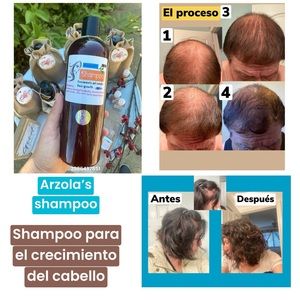 Arzola’s shampoo for‎ hair growth